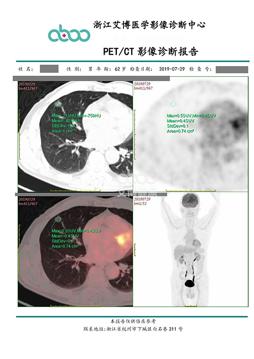 杭州艾博健康科技股份有限公司